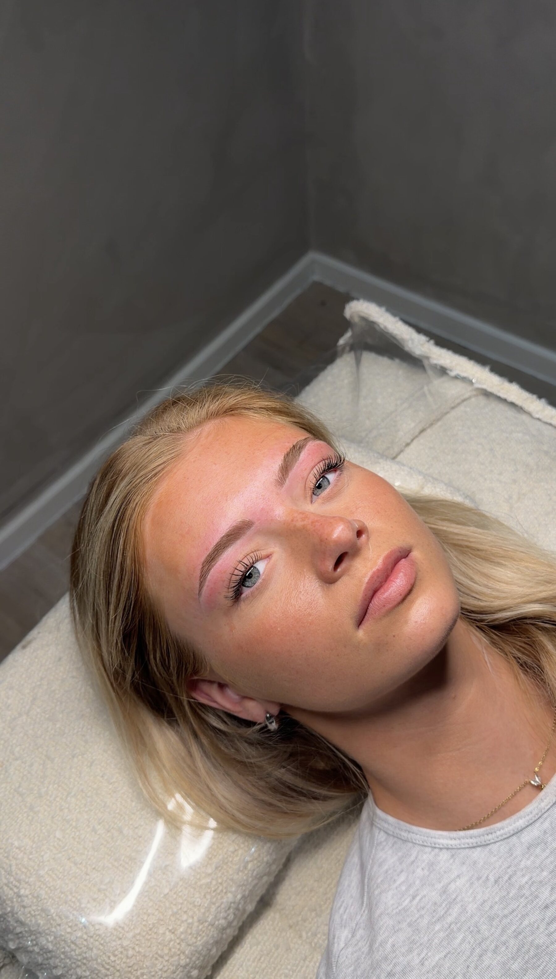 Brow behandeling resultaat
