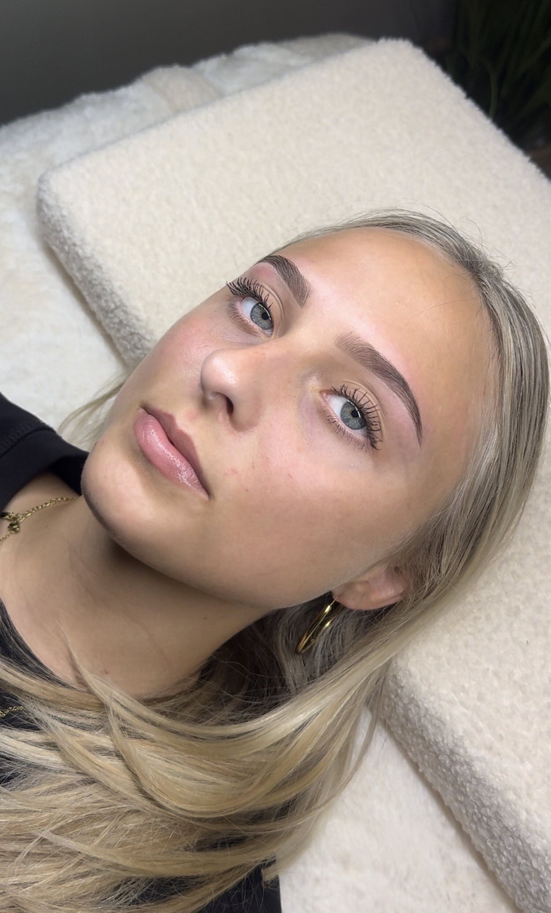 Brow behandeling resultaat