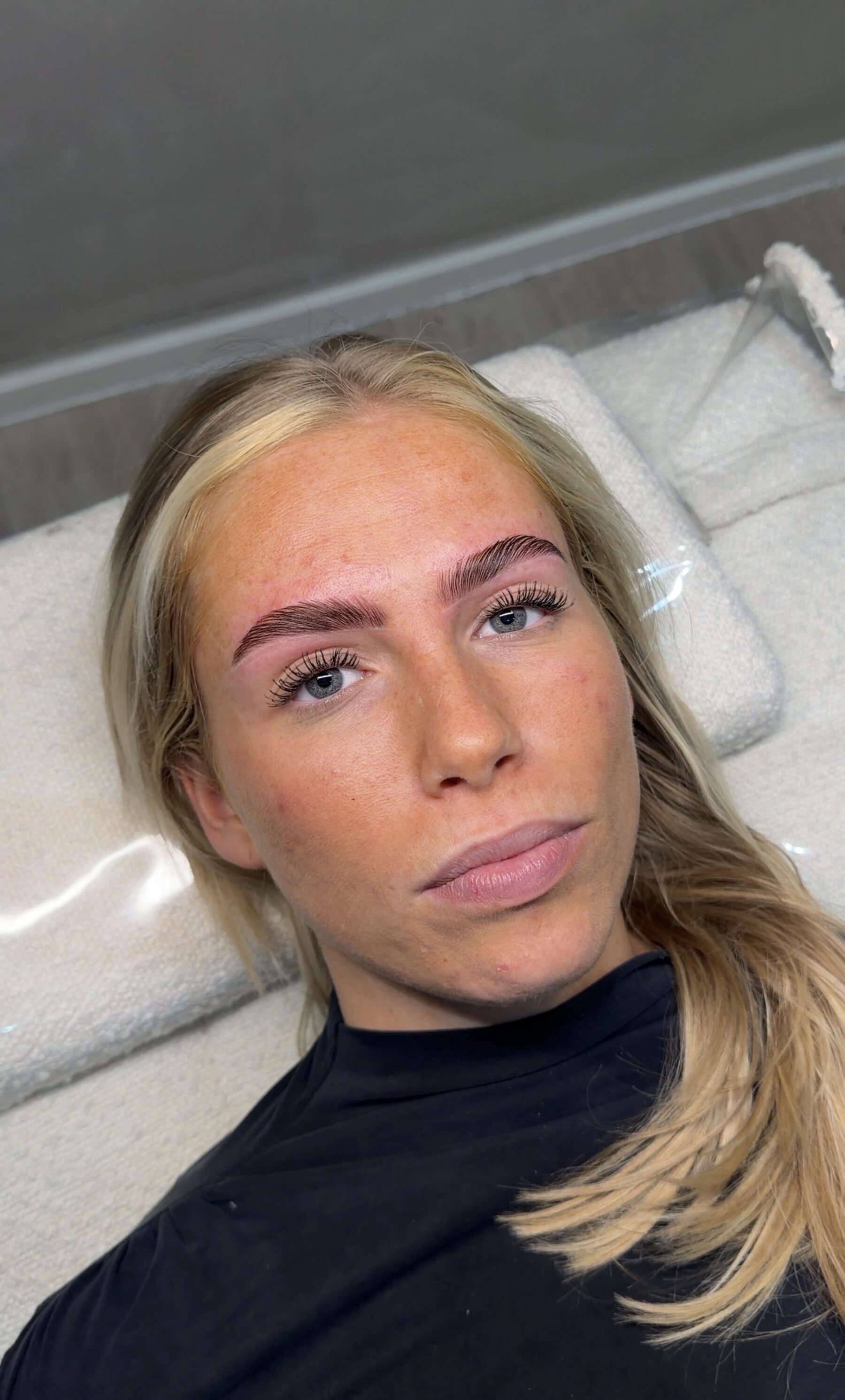 Brow behandeling resultaat