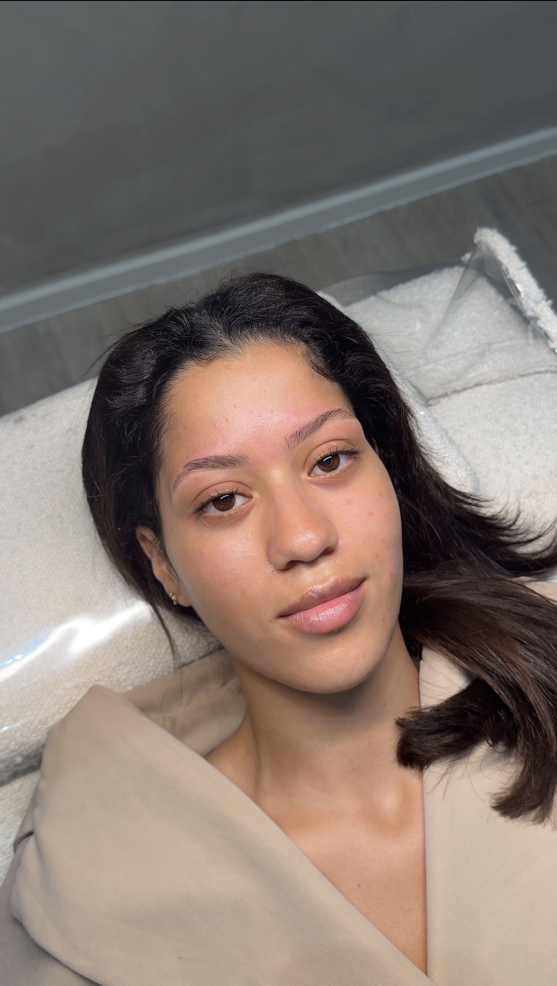 Brow behandeling resultaat